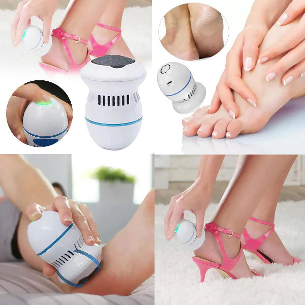 FootClean Pro™ – Exfoliador Eléctrico de Pies con Aspiración